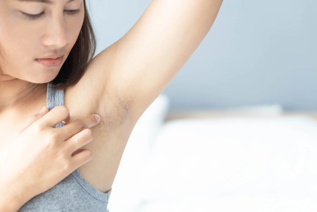 Warts Removal