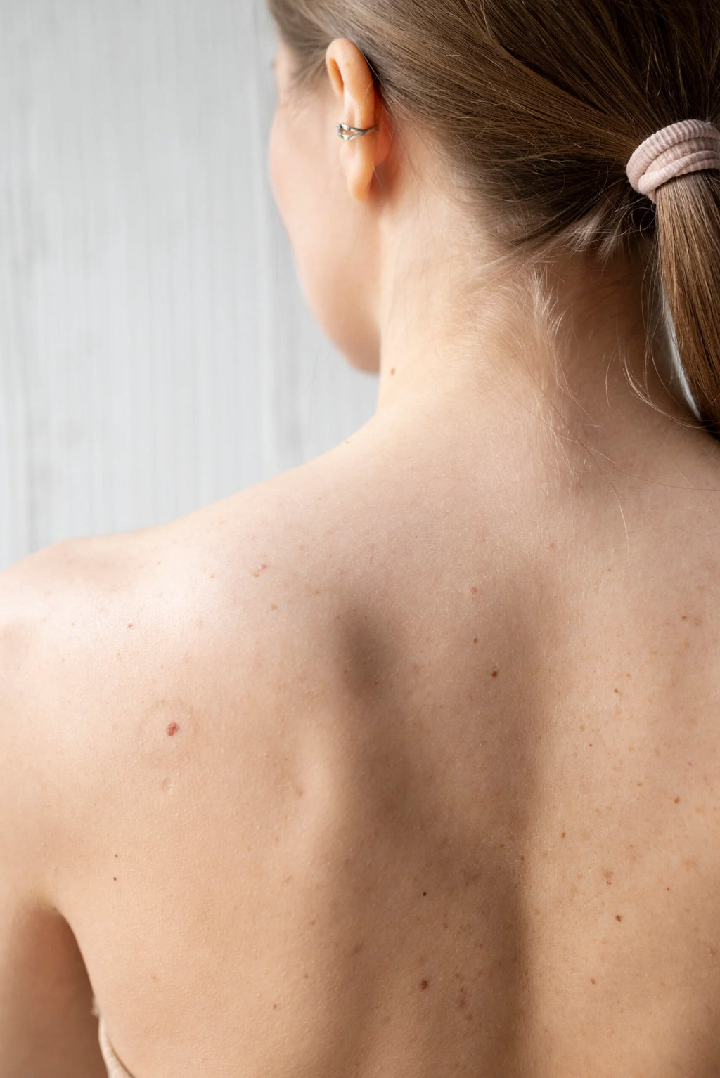 Warts Removal
